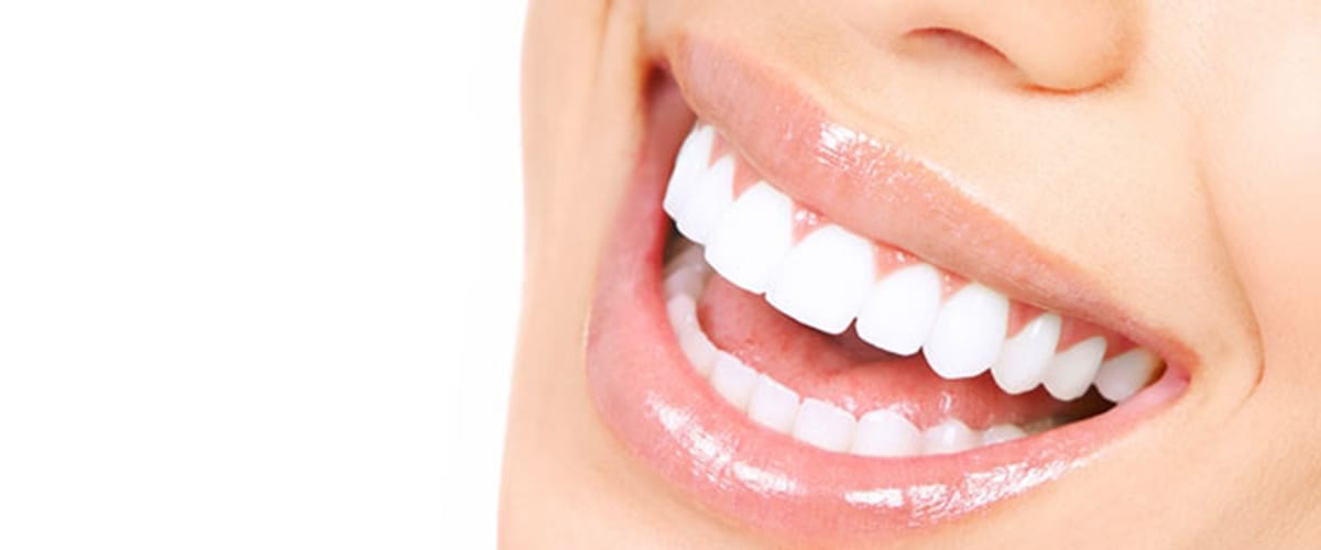 estética dental en calpe