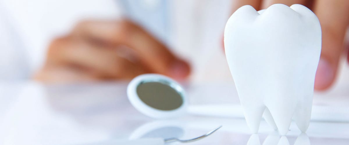Implantes dentales