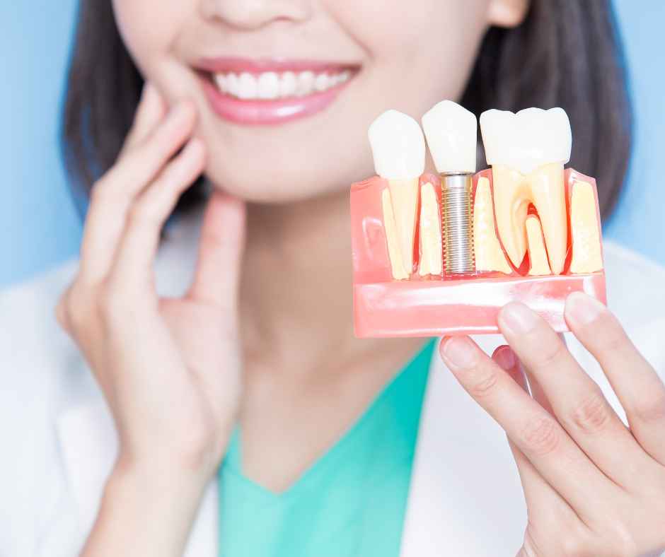 Implantes Dentales de Calidad en Calpe